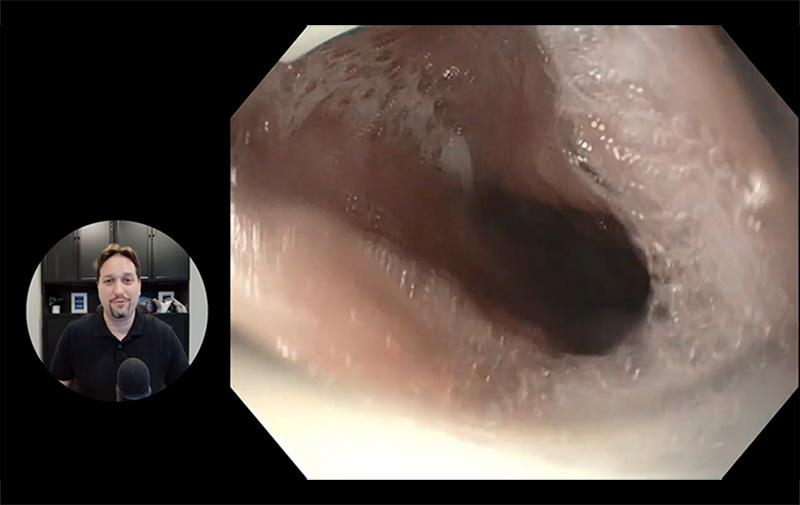 Dr Stuart Akerman's tutorial using the EVS